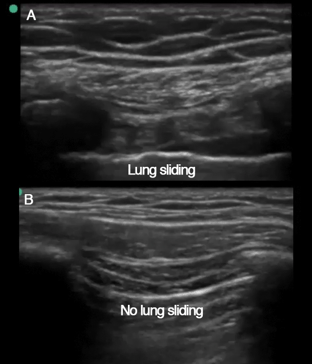 EEU case image missing